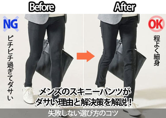 メンズのスキニーパンツがダサい理由と解決策を解説！ダサみえしないスキニーパンツもご紹介します。