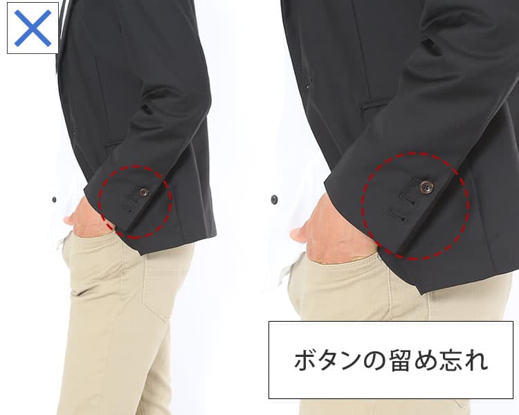 テーラードジャケットで意外と多い袖のボタンの留め忘れ