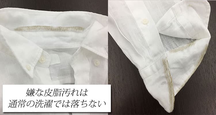 【原因】白シャツはなぜ黄ばむ・黒ずむ?