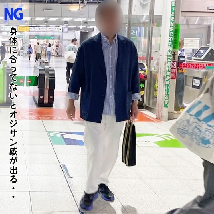 身体に合ってないサマージャケットを着たコーデ例